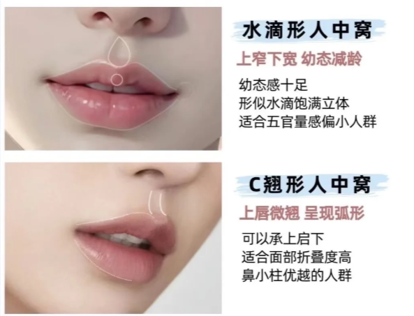 選傳統(tǒng)還是王皓民人中修復(fù)？看這3點(diǎn)就夠