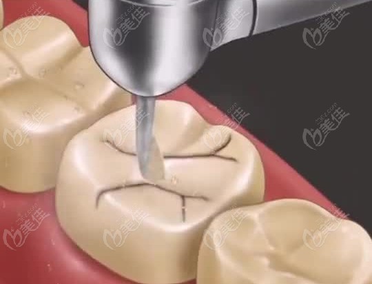 靖邊牙博仕口腔收費透明 靖邊牙博仕口腔收費透明