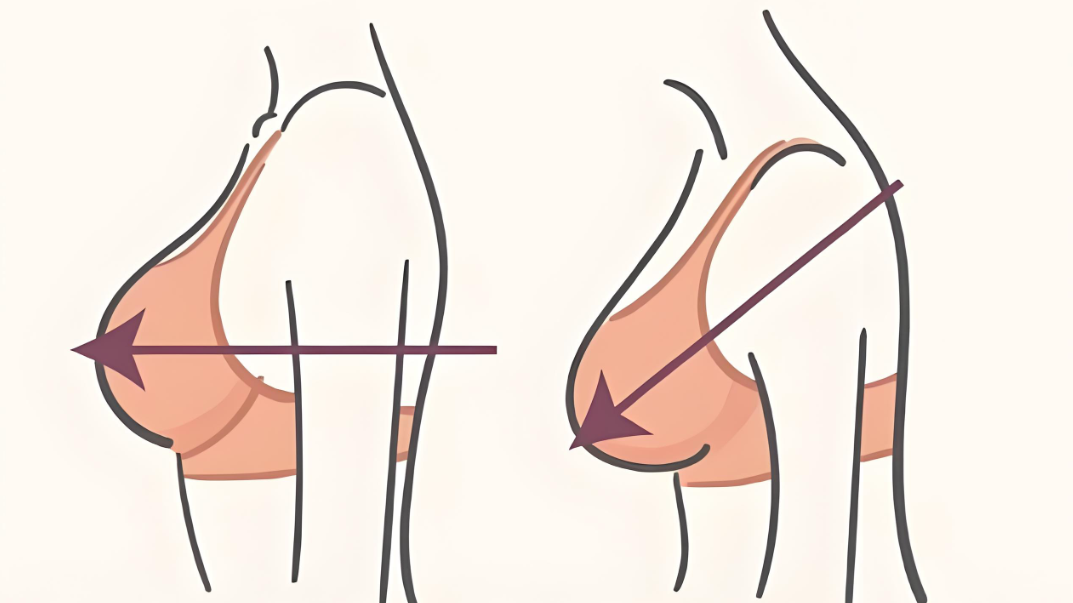 鄭州星顏頌縮胸手術(shù)怎么樣