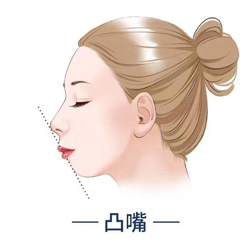 瀏陽東美口腔牙齒矯正多少錢