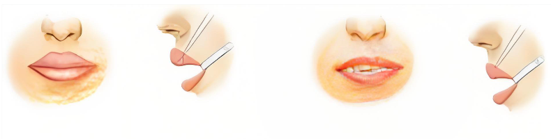 杭州沈劍唇醫(yī)生怎么樣？  二、