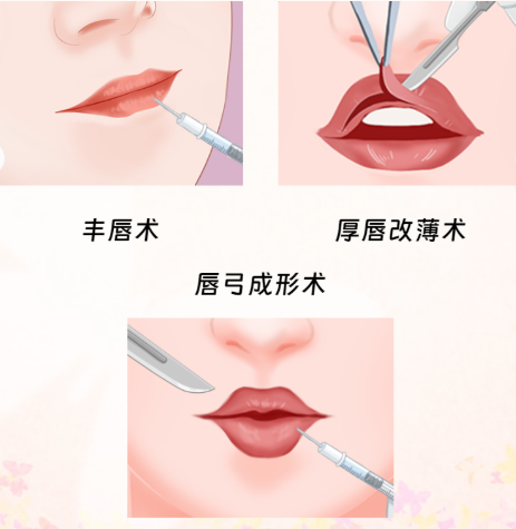 杭州沈劍唇整形特色項(xiàng)目：多樣唇部整形滿足需求