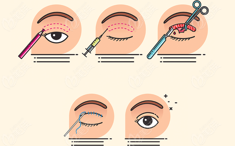 燦頭康永培醫(yī)生擅長項目