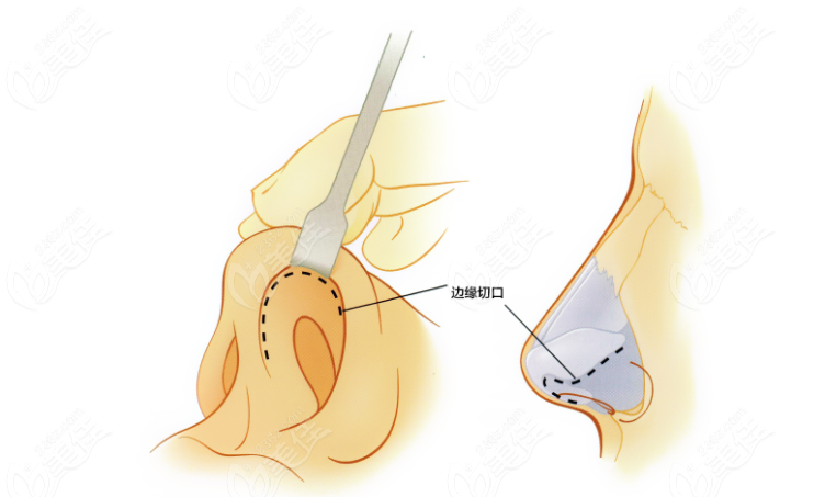 燦頭康永培醫(yī)生怎么樣？個人特點及真實口碑