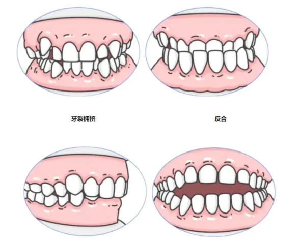 選擇杜衍曉醫(yī)生做正畸的優(yōu)勢