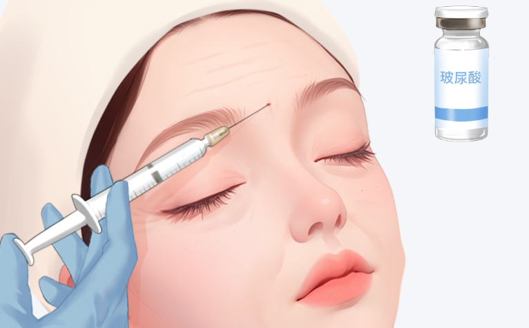 杭州馮嘯微量美學(xué)適合人群