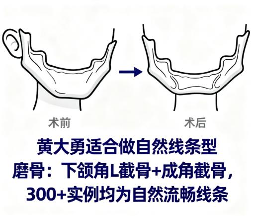 黃大勇做自然線條型磨骨的核心技術(shù)