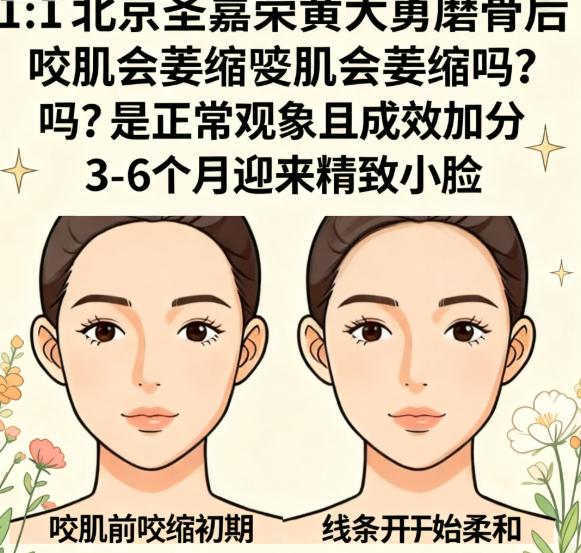 北京圣嘉榮黃大勇磨骨后咬肌會(huì)萎縮嗎