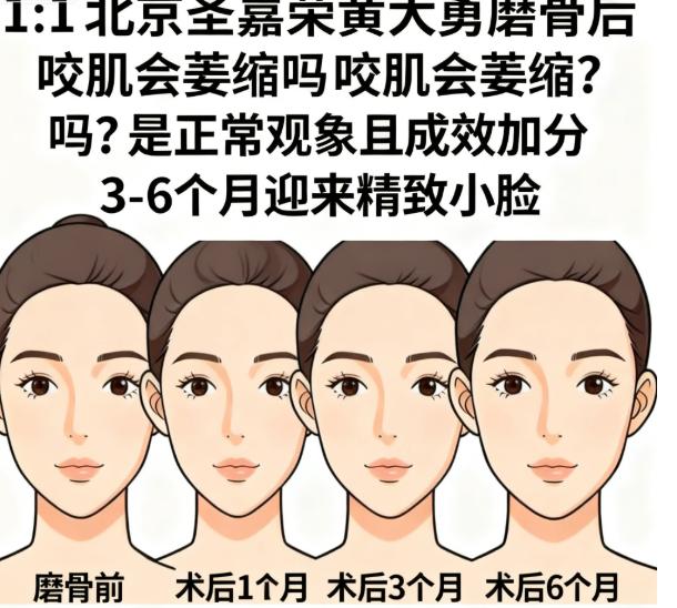 北京圣嘉榮黃大勇磨骨后咬肌萎縮的真實(shí)患者反饋：90%有輕度變化