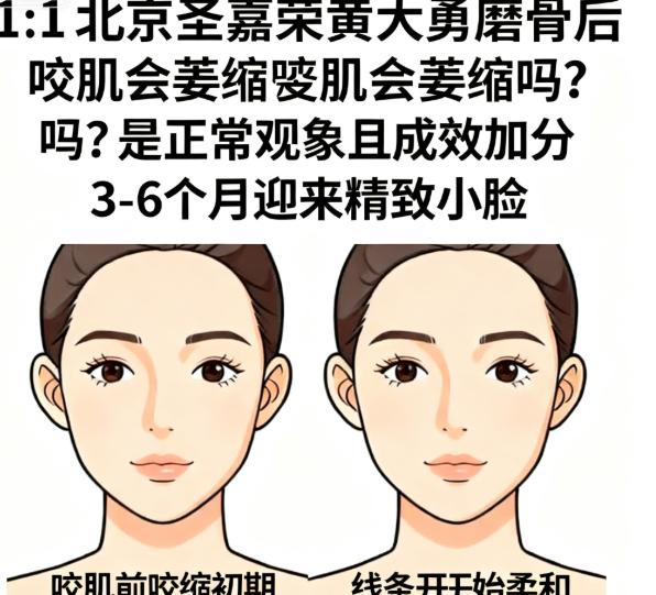 北京圣嘉榮黃大勇磨骨價(jià)格參考：3w-7w覆蓋不同項(xiàng)目