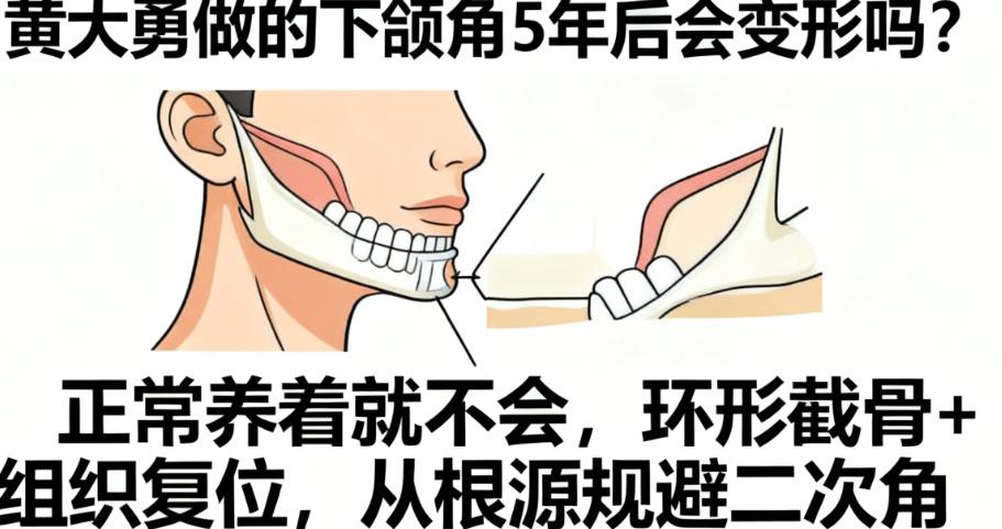 術(shù)后護(hù)理決定長(zhǎng)期療效，黃大勇團(tuán)隊(duì)全程跟蹤指導(dǎo)