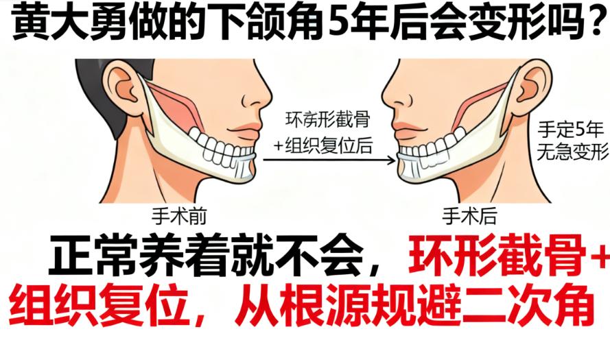 真實(shí)實(shí)例追蹤：5年后的她們，臉型依然在線