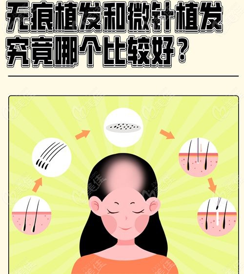 昆明青丝植发和碧莲盛比哪个好