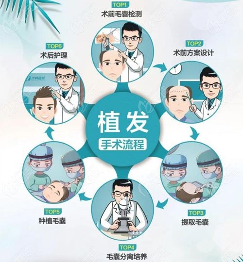 昆明青丝植发医生靠谱吗