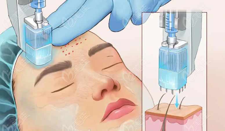 州素顏醫(yī)療美容楊超儒醫(yī)生怎么樣 州素顏醫(yī)療美容楊超儒醫(yī)生怎么樣