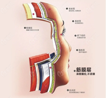 核心技術:筋膜層提升與固定 核心技術:筋膜層提升與固定