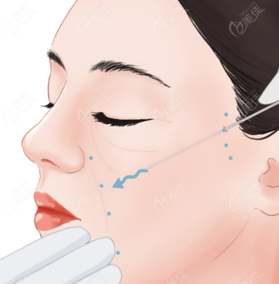 杭州玥相醫(yī)療美容李莎如何 杭州玥相醫(yī)療美容李莎如何