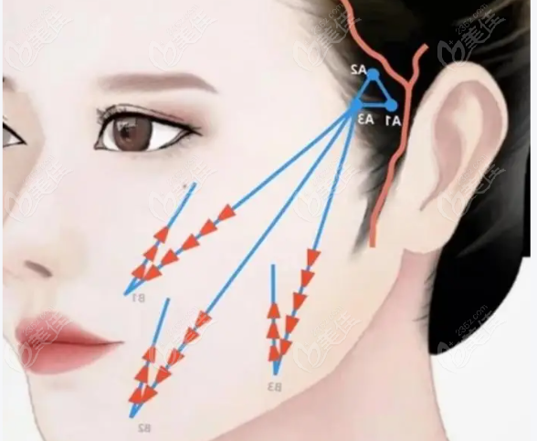 核心技術(shù):線雕藝術(shù)提升 核心技術(shù):線雕藝術(shù)提升