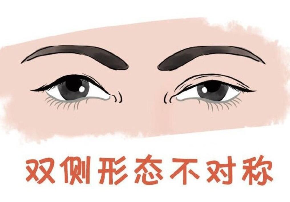 上海于曉雪修復(fù)眼睛技術(shù)咋樣