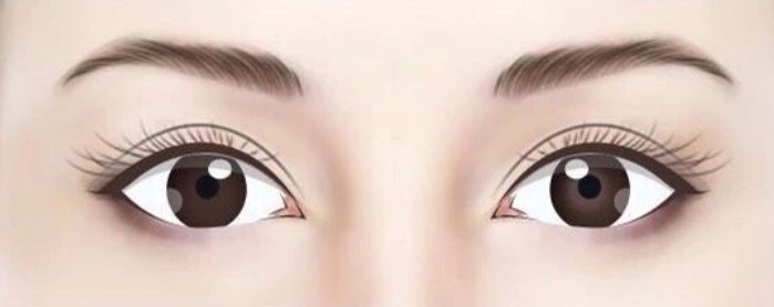 上海于曉雪修復(fù)眼睛靠譜