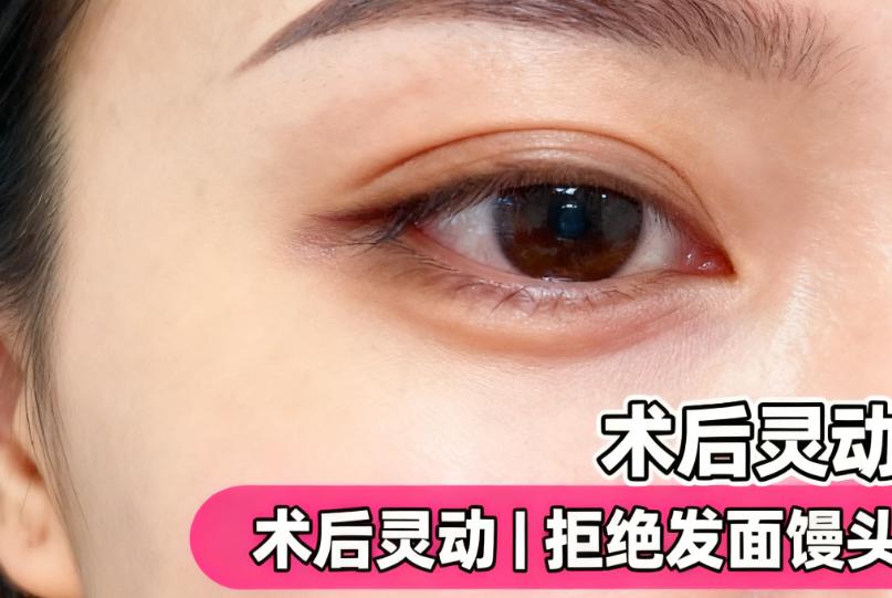 避開神經(jīng)線：安全是美的前提