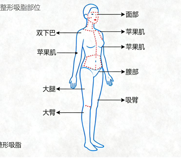 上海千美杜鹏吸脂
