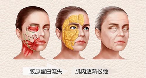 深圳杨建荣拉皮手术价格表