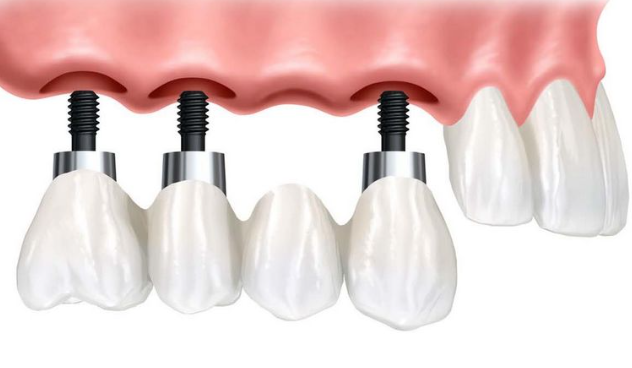婁底牙科醫(yī)院價目表