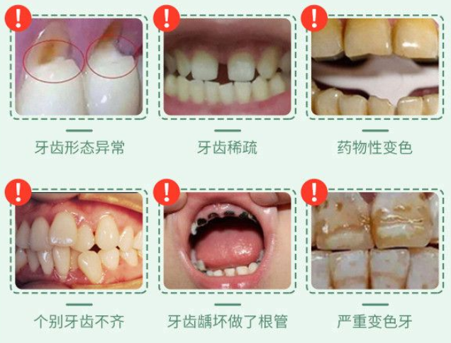麻陽(yáng)雅貝康口腔全瓷牙價(jià)格