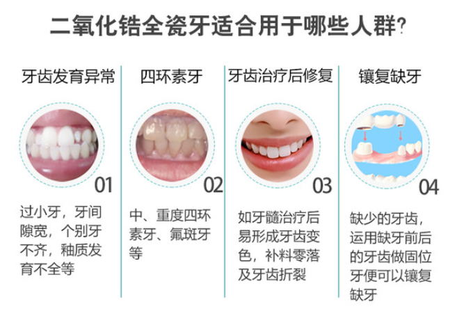 麻陽(yáng)雅貝康口腔全瓷牙價(jià)格