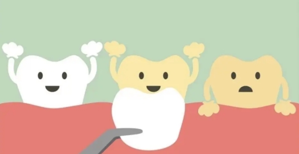 咸陽(yáng)牙齒貼片醫(yī)院