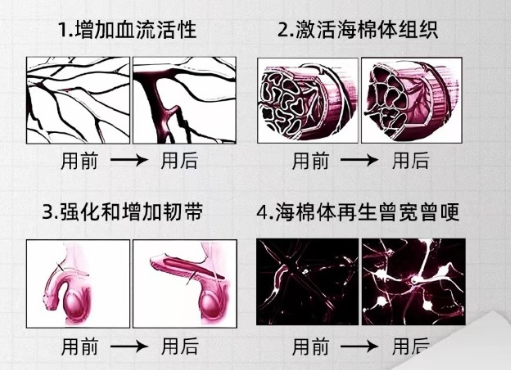 黄金自生原液增粗2-3公分的原理与疗效