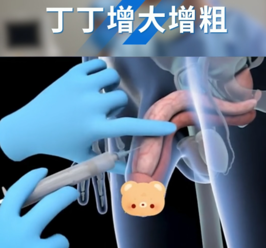 黄金自生原液增粗的真实疗效