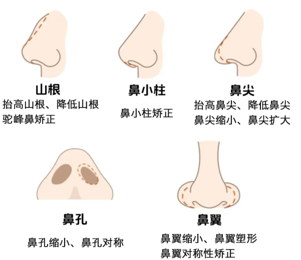 王宇琨和段燾誰(shuí)膩害？隆鼻選對(duì)醫(yī)生就踩這3個(gè)點(diǎn)