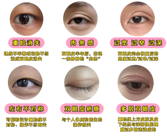 影響劉輔容皮瓣移植修復(fù)后疤痕的3個(gè)關(guān)鍵因素