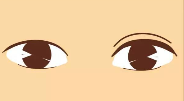 上海雙眼皮改單眼皮好的醫(yī)生名單