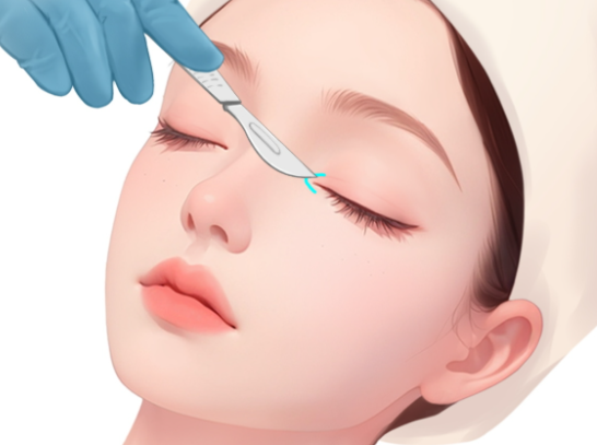 上海雙眼皮改單眼皮哪個醫(yī)生好