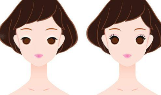 張菡雙眼皮松單真實評價好