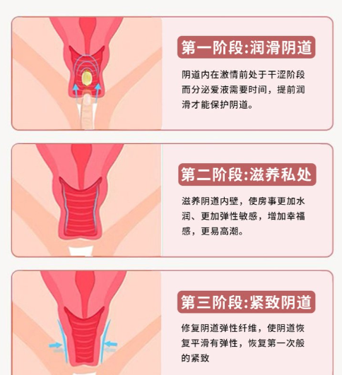 九龍/虹橋/宏康哪家緊縮技術更靠譜