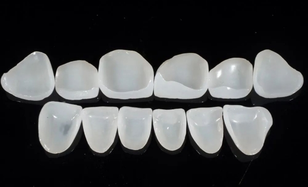 咸陽(yáng)牙貼片價(jià)格表2025價(jià)格差異