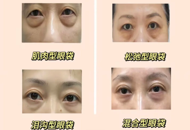 年輕肌選劉寧，到底“香”在哪？