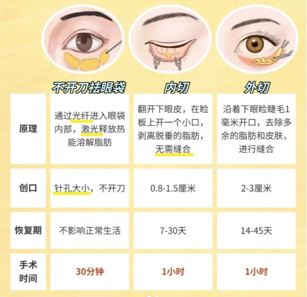 達芬奇不開刀祛眼袋的優(yōu)勢