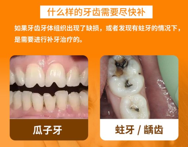 耒陽雅貝康口腔補牙治療收費