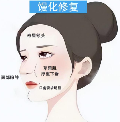 韓可旺專注饅化提升價(jià)格表