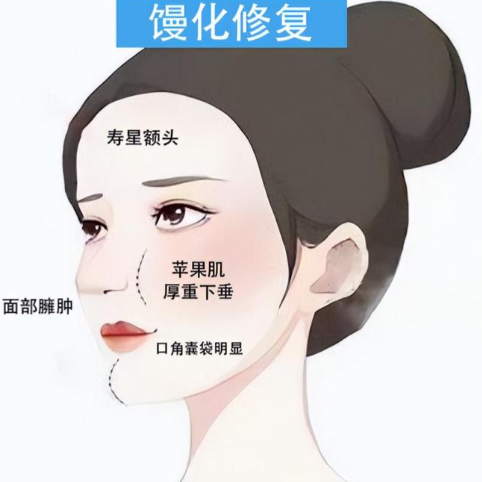 韓可旺擅長饅化修復(fù)做得好