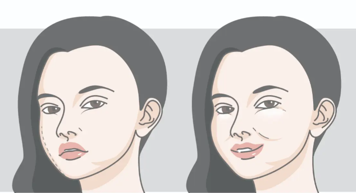 韓可旺饅化修復(fù)真實(shí)實(shí)例