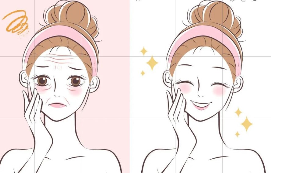 韓可旺面部韌帶提升真實(shí)實(shí)例