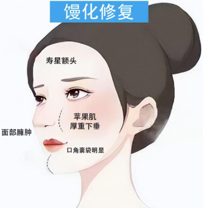 王洪醫(yī)生修復(fù)生長因子饅化臉好