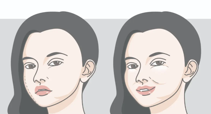 上海韩可旺医生馒化修复真实实例