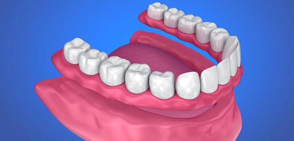 延安市吸附性義齒價格差異分析